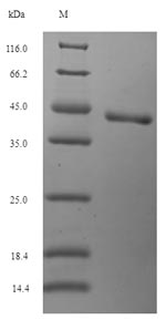Human OGG1 protein