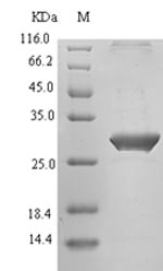 Human TIGIT protein