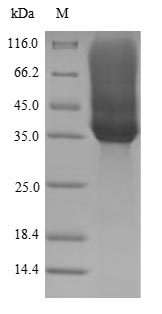 E. coli FIMH protein