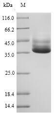 Bacterial MGLB protein