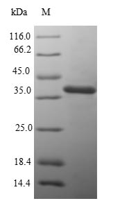 Bacterial MGLB protein