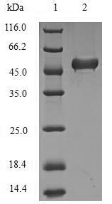 Human BRCC3 protein