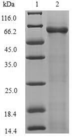 E. coli RTCB protein