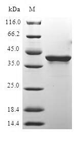 Human H2AFX protein