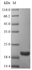 Human ATP5D protein