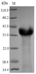 Human LMP1 protein