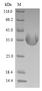 Human LMP1 protein