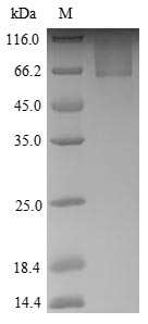Human SNTG1 protein