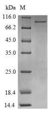 Human DDX3X protein