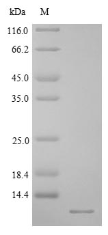 Rat CRYGB protein