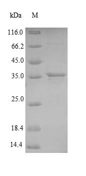 Bacterial ADK protein
