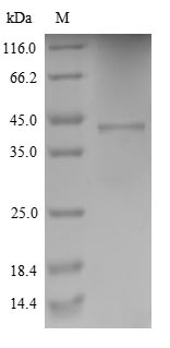 Human CYBB protein
