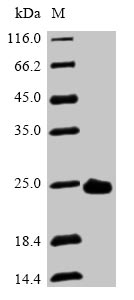 Human PRDX2 protein