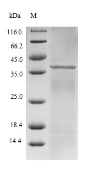 Human RANBP2 protein