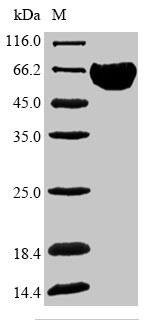 Human SLC4A1 protein