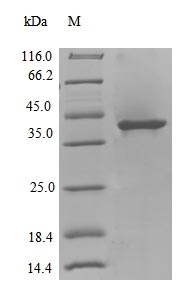 Bacterial DINB protein