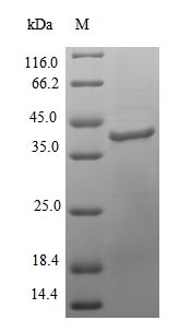 Bacterial DINB protein