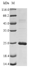 Human CTAG1A protein