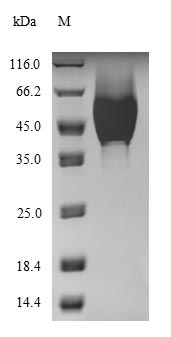 Bacterial HLGC protein