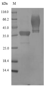Bacterial HLGB protein