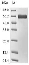 Bacterial NADB protein