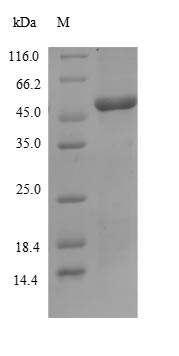 Human SLC4A1 protein