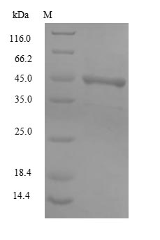 Human Major capsid protein VP1 protein