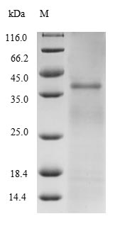 Bacterial FBPB protein