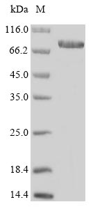 Human ENOX1 protein