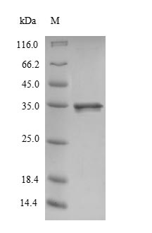 Rat CALM1 protein