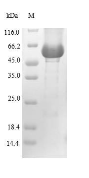 Human GBA protein