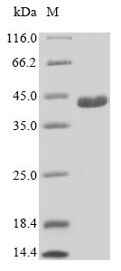 Human C21ORF2 protein