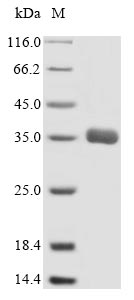 Human ABCC1 protein