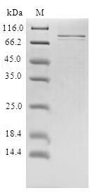 Human PRLR protein