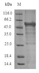 Human ADIPOR1 protein