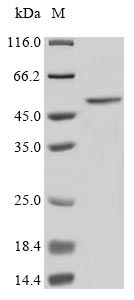 Human ST6GAL1 protein