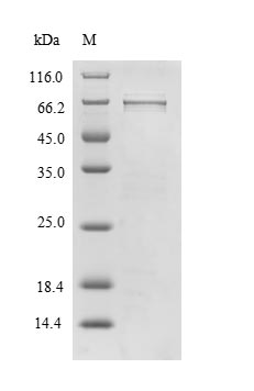 Human TXNIP protein