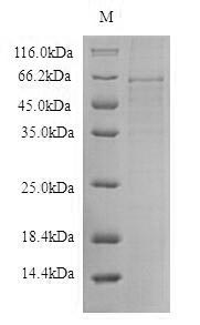Human TXNIP protein