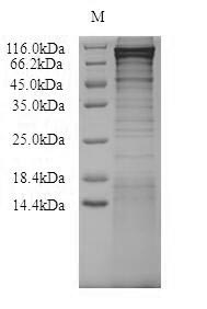 Human UBTF protein