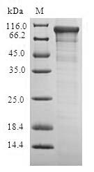 E. coli CYAA protein
