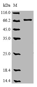 Human OPTN protein
