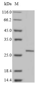 Rat SOSTDC1 protein