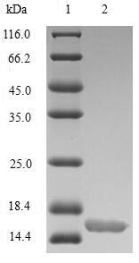 Human GLP1R protein