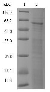 Human POLM protein