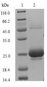 Rat SOSTDC1 protein