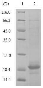 Rat TGF beta Receptor 2 protein