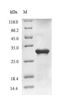 Viral Matrix protein 1 protein