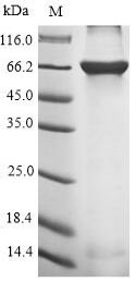 Viral Glycoprotein protein