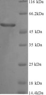 Human Vitamin D-binding protein protein