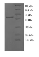Human Protein E7 protein